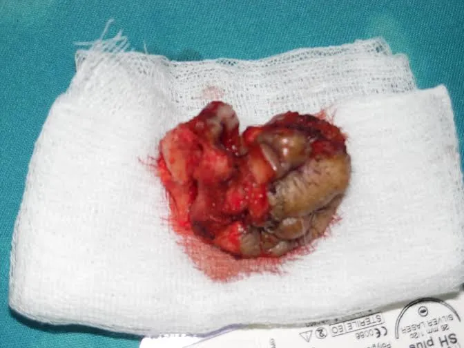 فريق سويسري يجري عمليات نادرة بموريتانيا