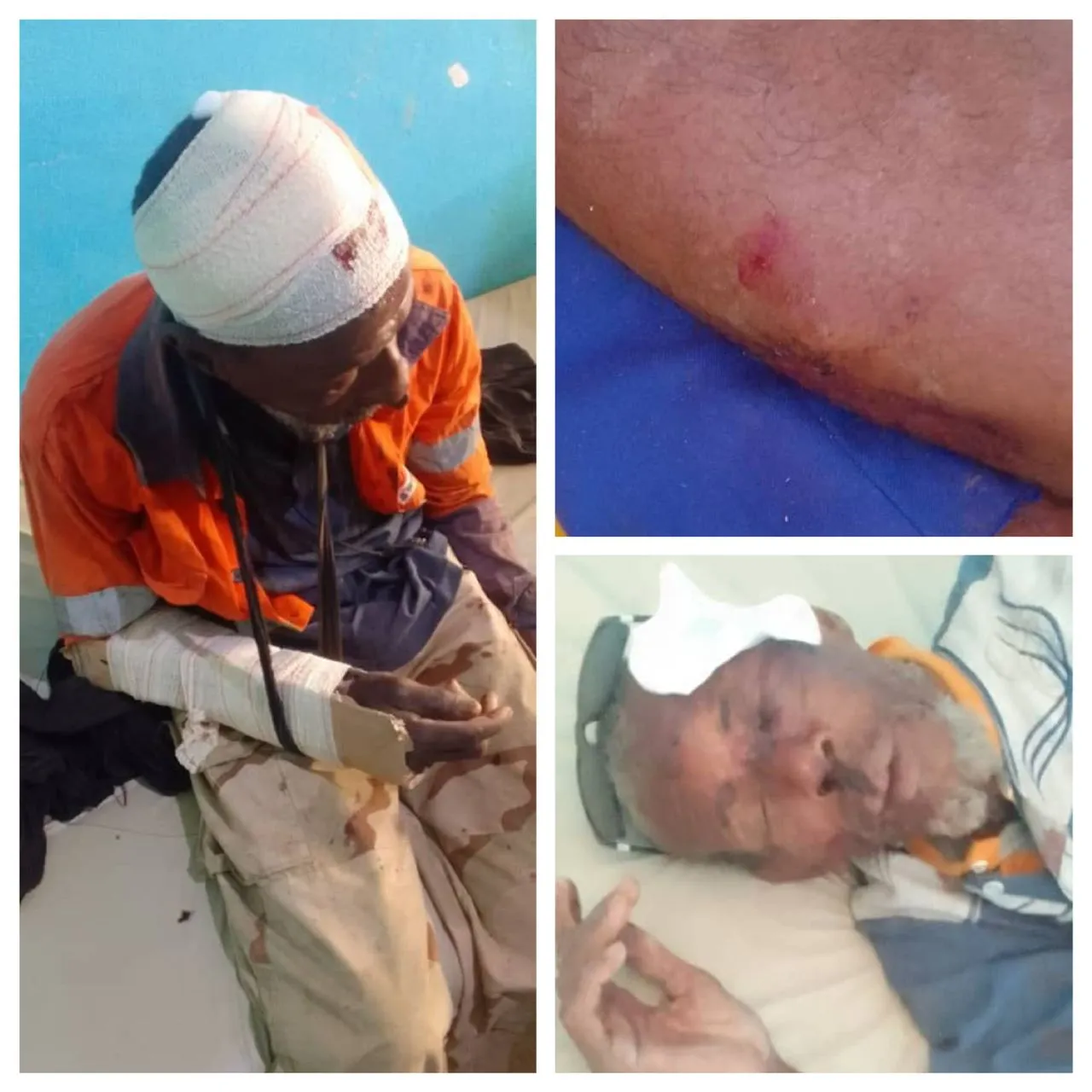 بعض المصابين جراء النزاع على المنطقة الزراعية في بابابى بولاية البر?